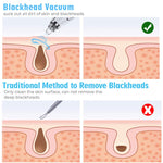 Blackhead Remover - 5 Intensities - Black & White