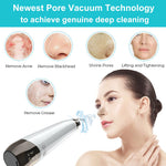 Blackhead Remover - 3 Intensities - White