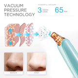 Blackhead Remover - 3 Intensities - Green